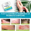 Psoriasis Cream, Scalp Treatment for Face and Body, Effective for Psoriasis, Folliculitis Treatment, Dry Scalp, Dandruff, Seborrheic Dermatitis Treatment, Herbal Anti Itch Cream Extra Strength