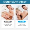 Shaboo Prints Anti Snoring Devices, Silicone Anti Snoring Nose Clip, Comfortable Sleeping Aid Relieve Snore (4 PCS)