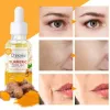 Upgrade Turmeric Dark Spot Corrector Serum, Natural Turmeric Dark Spot Skin Care Moisturizing Repair Serum
