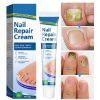 Picture of Toenail Fungus Treatment, Nail Repair Cream, Toe Nail Treatment Extra Strength, Repairs and Renew Damaged, Broken, Cracked & Discolored Nails