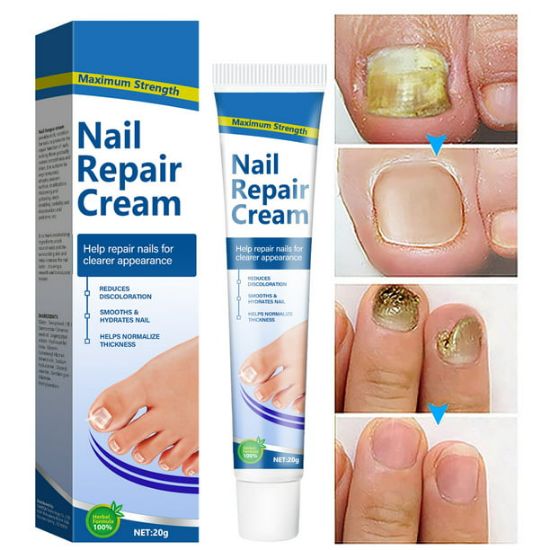 Picture of Toenail Fungus Treatment, Nail Repair Cream, Toe Nail Treatment Extra Strength, Repairs and Renew Damaged, Broken, Cracked & Discolored Nails