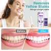 Picture of Purple Toothpaste for Teeth Whitening, Purple Teeth Whitening Toothpaste, Tooth Colour Corrector - Reduce Yellowing & Tooth Stain Removal