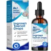 Picture of Ingrown Toenail Treatment, 30ml