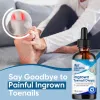Picture of Ingrown Toenail Treatment, 30ml