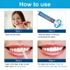Picture of Teeth Whitening Pen, Teeth Whitening Gel, Color Correcting for Tooth Stain Removal, 4 PCS