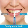 Picture of Teeth Whitening Pen, Teeth Whitening Gel, Color Correcting for Tooth Stain Removal, 4 PCS